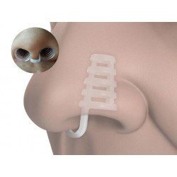 Horlama Burun Aparatı - Kafesli Horlama Burun Aparatı - Kafesli